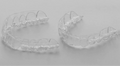 Custom Whitening Trays